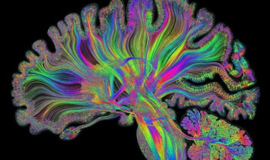 Ein farbenfroher Baum mit mehreren Farben